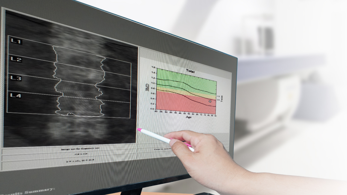 DEXA Scan